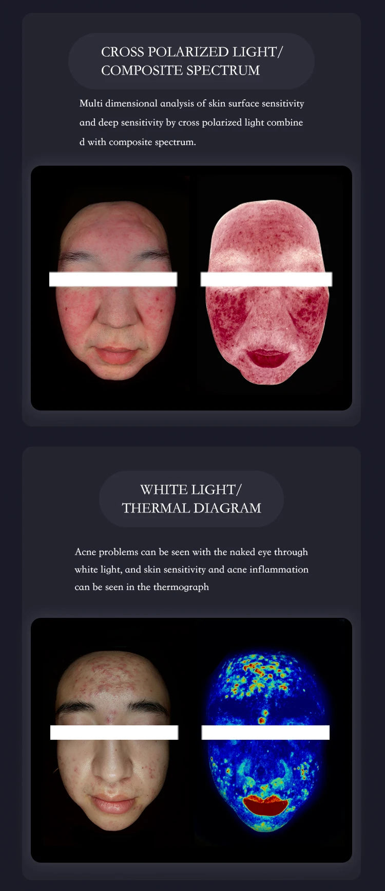 New 3D Facial Skin Analyzer Machine 15.6 inch