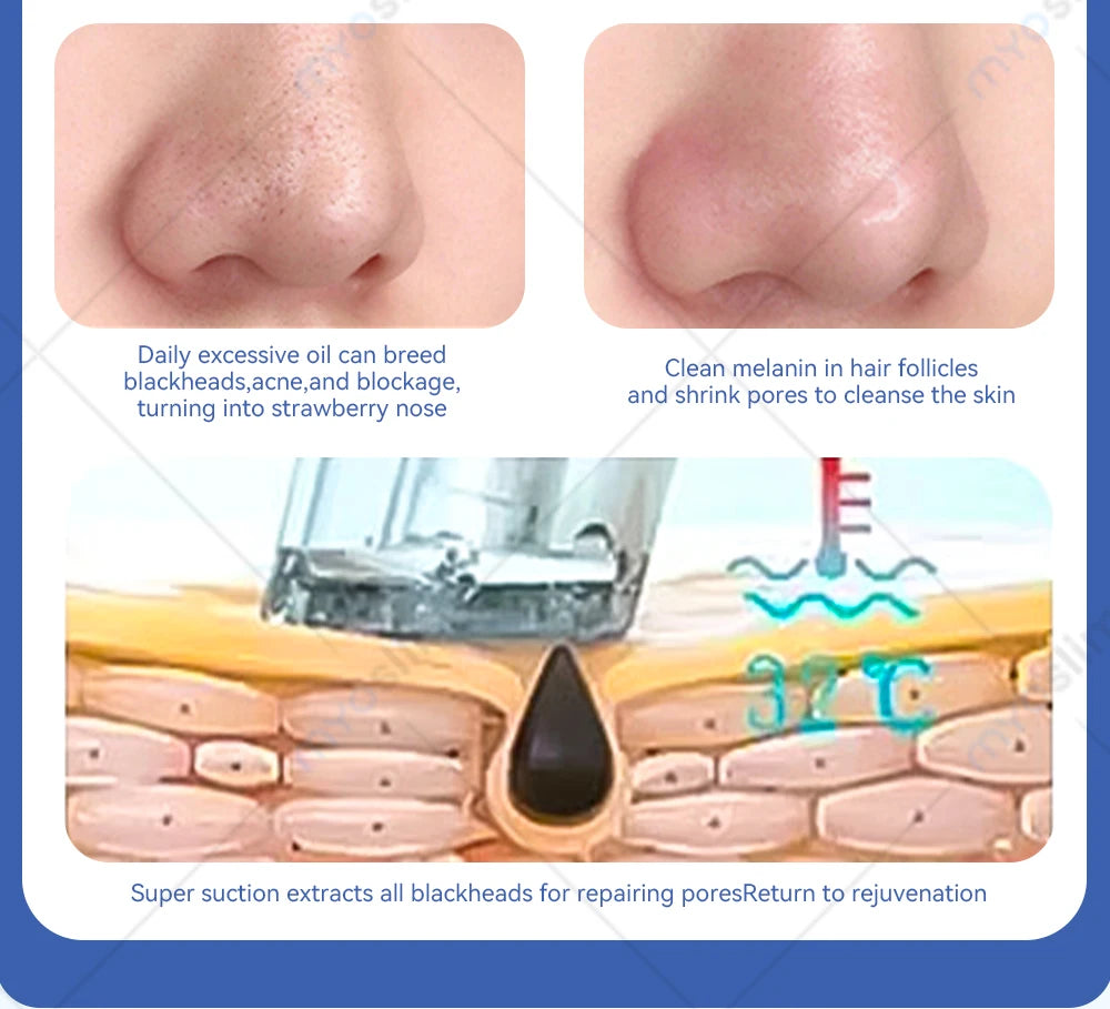 Oxygen Skin Moisturizing Beauty Machine Deep Cleansing