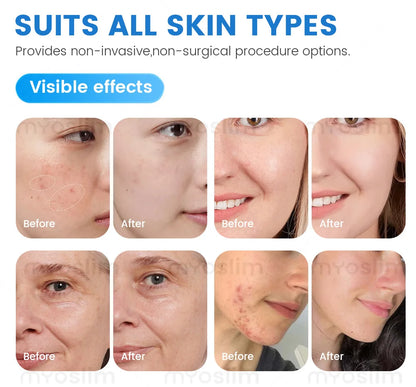 Portable 6-in-1 Hydro Machine Jet Peel Skin Care